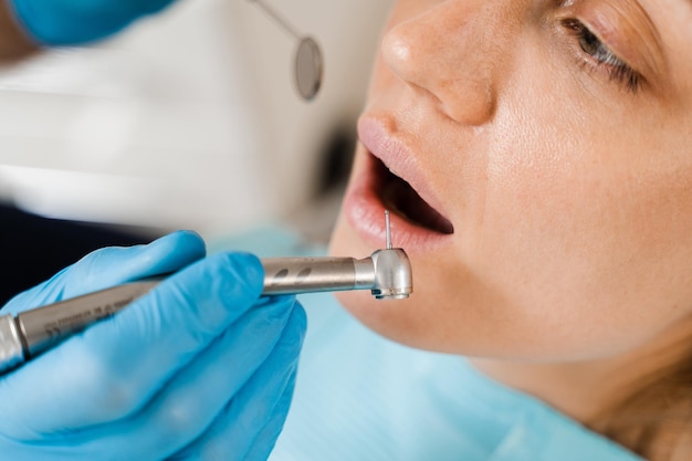 歯科用ドリルのクローズ アップ 歯科医が歯科医院で女性の歯を掘削
