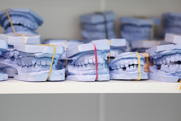 Dental gypsum models cast of a human dental jaw Gypsum models lie on a shelf in a row