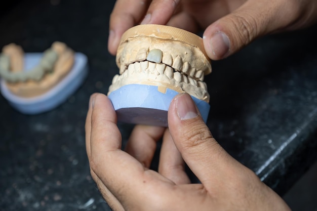 Photo dental gypsum models in dental laboratory with single tooth crown to be tested for teeth occlude correctly
