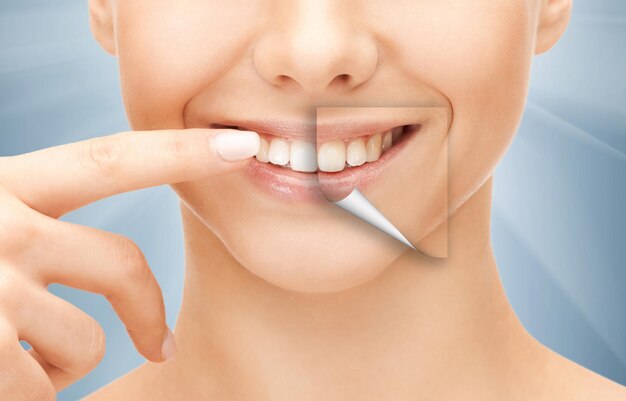 dental health concept - beautiful woman pointing to her teeth