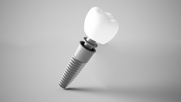 Dental implant 3d rendering