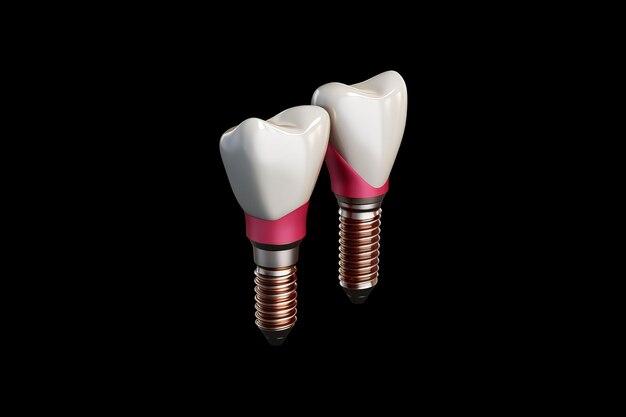 Dental implant Health medical care Generate Ai