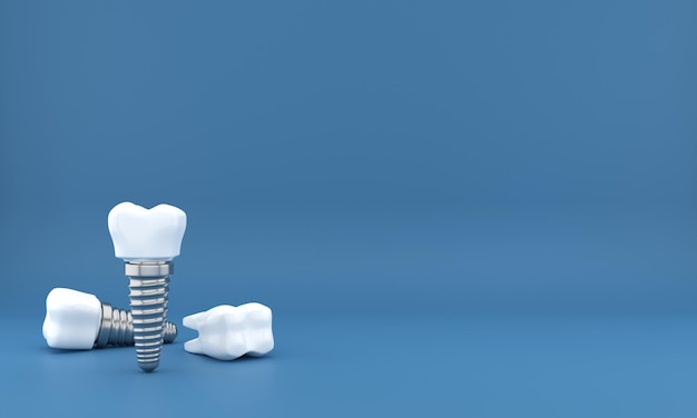 Photo dental implants surgery 3d rendering