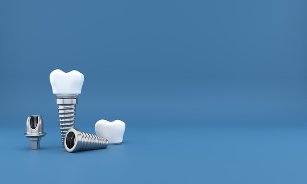 Dental implants surgery 3d rendering