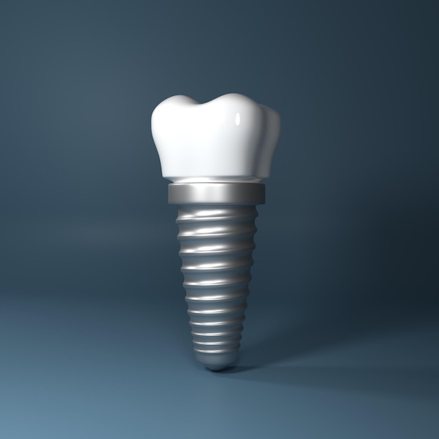 Dental implants surgery 3d rendering