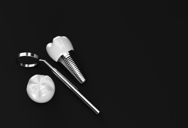 치과 임플란트 수술 개념 3D 렌더링입니다.