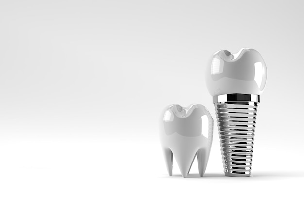 Dental Implants surgery concept 3D Rendering.