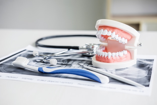 Dental model and equipment on tooth x-ray film and stethoscope used in the treatment