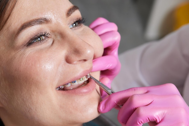 Foto procedura dentale per l'installazione di apparecchi dentali da vicinola procedura per la cura dei denti e delle gengive in bocca