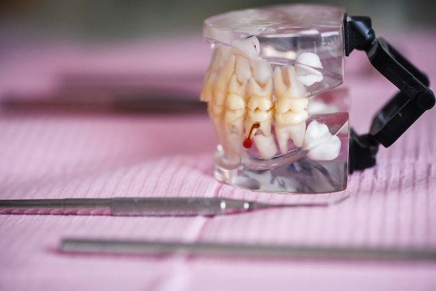 Dental prosthesis