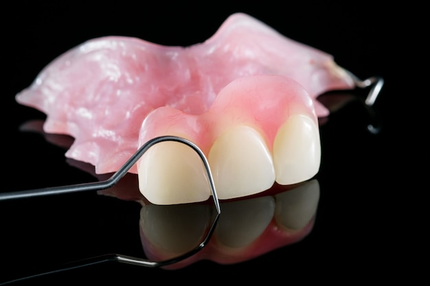 Dental prosthetic isolatic - partial denture upper side.