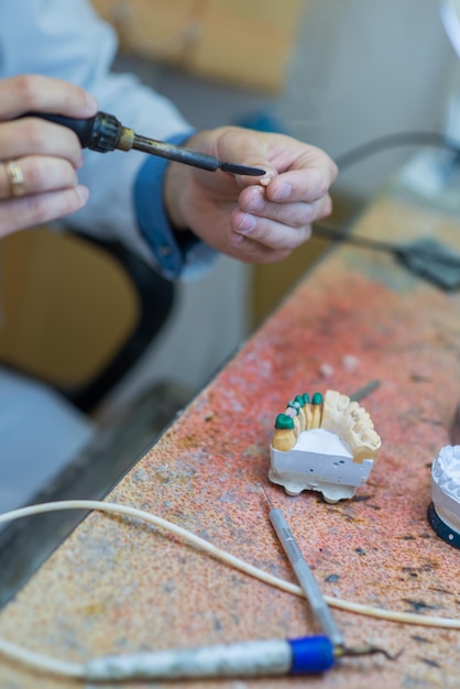 A dental technician makes partial dentures The production of false teeth or dental bridges Closeup