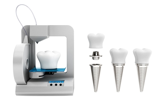 Dental technology concept. 3d printer printing tooth implant