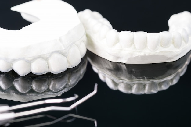 Dental  tools  and retainer orthodontic appliance on the black background.