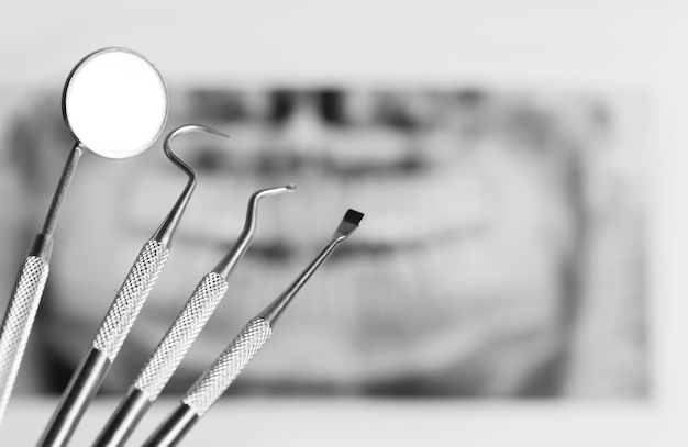 Photo dental tools on white background with x rey top view