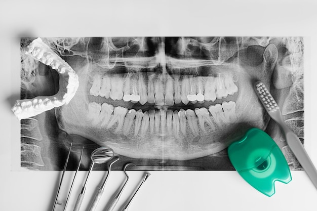 X 레이 평면도와 흰색 배경에 치과 도구