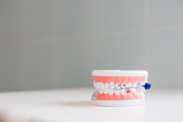 Dental tooth dentistry . model showing teeth, roots, gums, gum disease, tooth decay and plaque.