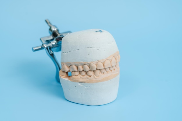 치아 뿌리 잇몸 잇몸 질환 충치 및 플라크를 보여주는 치과 치아 치과 학생 학습 교육 모델