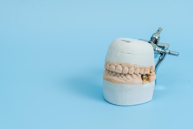 Dental tooth dentistry student learning teaching model showing teeth roots gums gum disease tooth decay and plaque