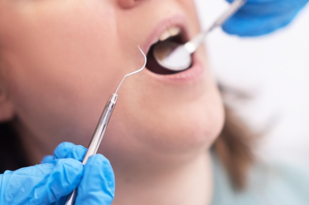 歯科専門の歯科施設による彼女の口腔の健康を維持するための歯科治療をクローズ アップ