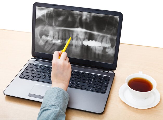 Dentist analyzes Xray picture of jaws on laptop