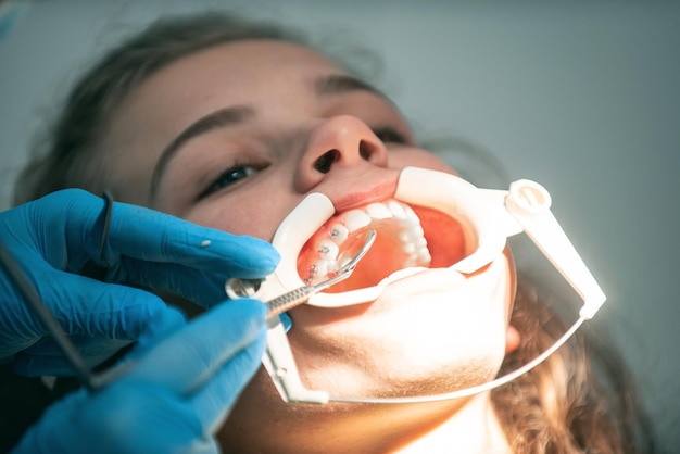 Прием стоматолога в стоматологической клинике, размещение брекетов на зубах и вытягивание дуги, чтобы