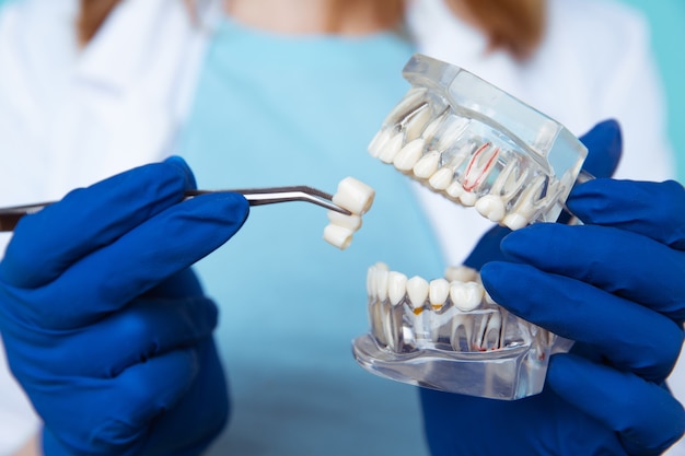 Appuntamento dal dentista, strumenti di odontoiatria e concetto di controllo igienista dentale con dentiere modello denti e strumenti di stomatologia su grigio scuro. controlli regolari sono essenziali per la salute orale