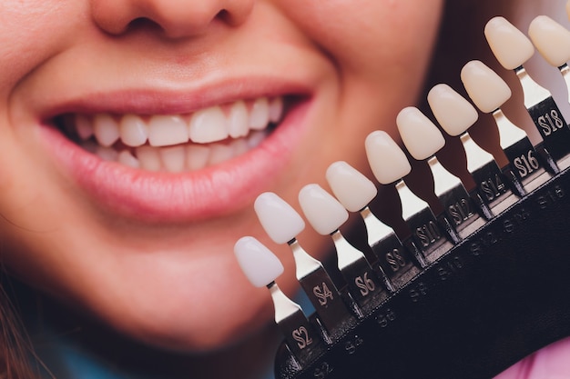 The dentist comparing patient's teeth shade with samples for bleaching treatment.