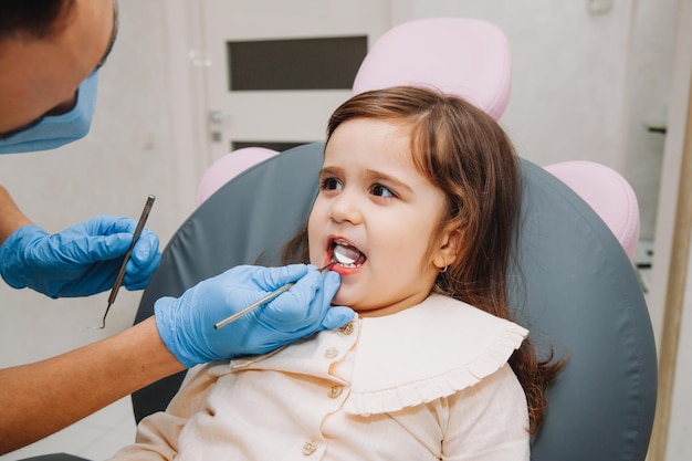 Стоматолог, врач осматривает ротовую полость маленькой девочки, использует ротовое зеркало, крупным планом молочные зубы, концепция детской стоматологии, лечение зубов.
