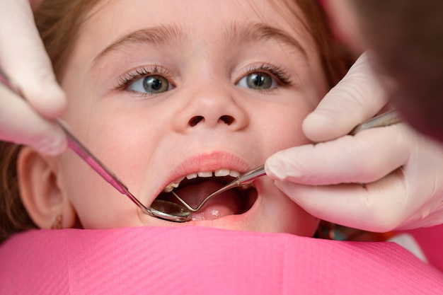 The dentist examines the baby girl's baby teeth the treatment of baby teeth the dentist holds a mirror