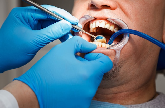 Photo dentist examines a man's teeth for caries