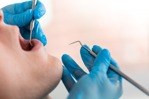 Foto un dentista esamina la cavità orale del paziente