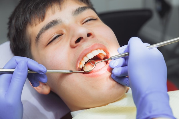 The dentist examines the teeth of a boy of 13 years old in the clinic pediatric dentistry