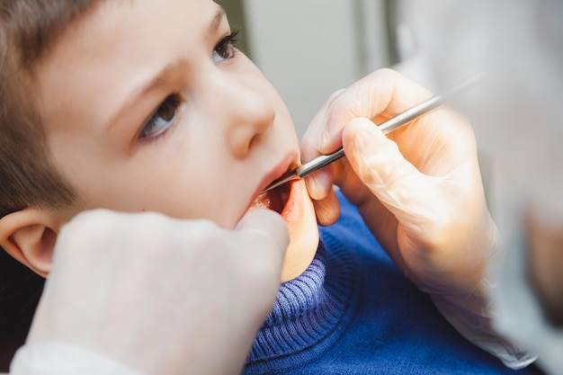 The dentist examines the teeth of a little boy a patient in a dental clinic