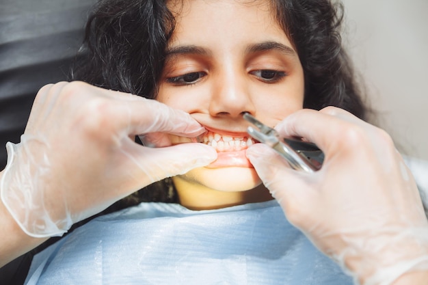 치과 의사는 어린 소녀 소아 치과 치과 치료의 치아를 검사합니다