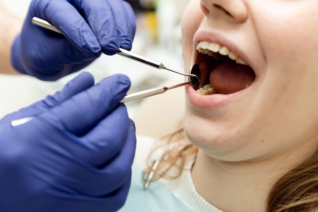 歯科医は、歯科医院の齲蝕歯科治療で医師の予約で歯科治療の女の子の患者のクローズアップの歯を調べます