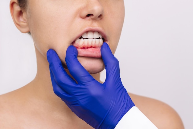 건강한 잇몸을 보여주는 파란 장갑을 끼고 젊은 여성의 잇몸을 검사하는 치과의사
