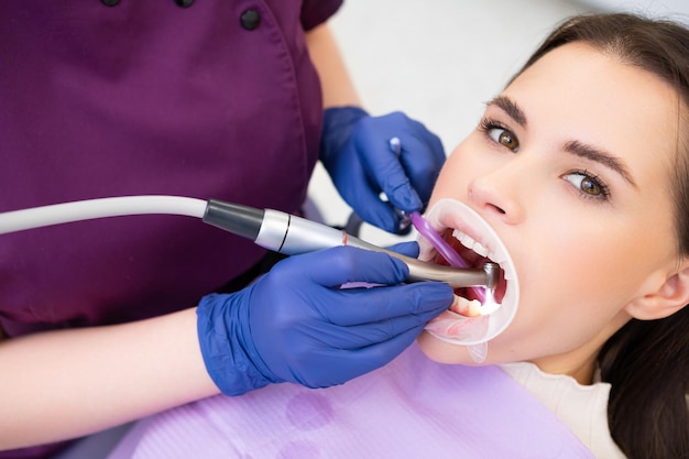 Dentist filling the tooth to the woman patient