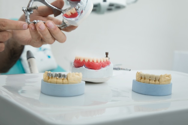 The dentist holds a mock jaw in his hand