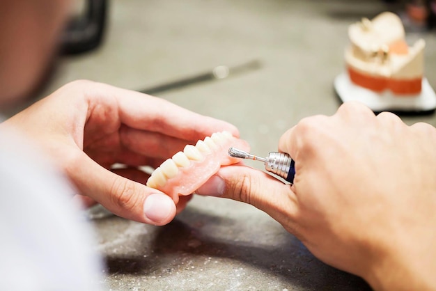 Стоматолог использует стоматологический инструмент для снятия протеза с зуба.
