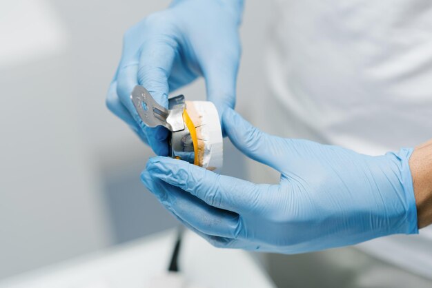 The dentist makes an impression of the teeth Closeup of a dentist in blue gloves