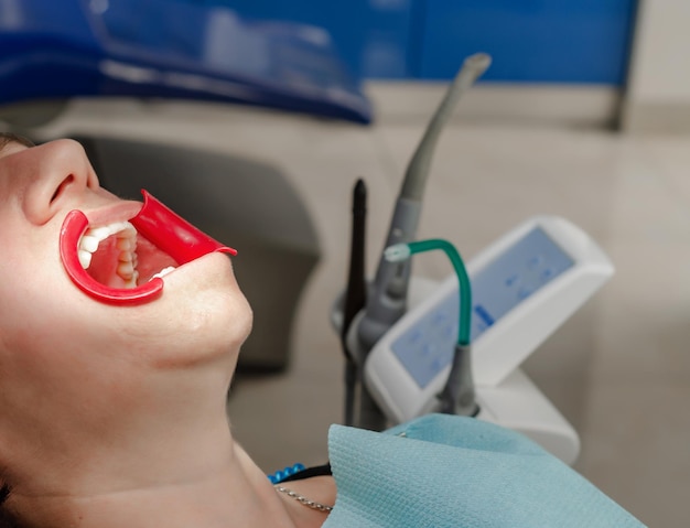 Dentist patient in chair mouth open