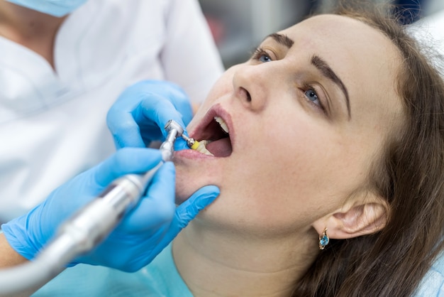 Стоматолог полирует зубы пациента после процедуры отбеливания