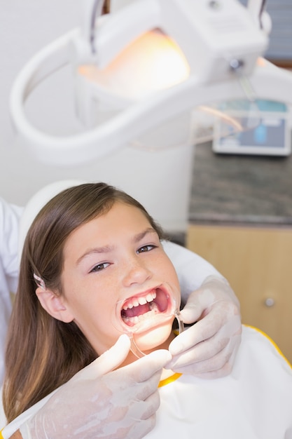 Dentista che mette il divaricatore della bocca sulla bambina