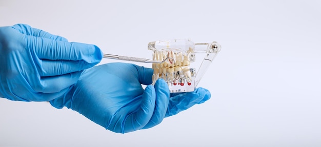 Foto la mano del dentista in un guanto blu tiene un modello di mascella dentale indica un dente mancante