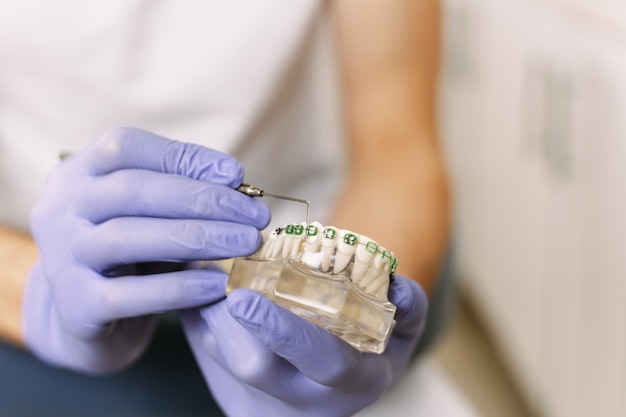 The dentist shows an artificial model of the jaw with braces and points to it with a dental tool. dentist in purple rubber gloves shows new dental braces for patients