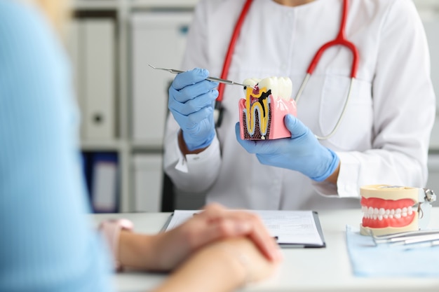 Dentist shows on dental model how caries destroys tooth enamel