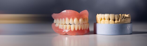 Photo dentist teeth and gums model