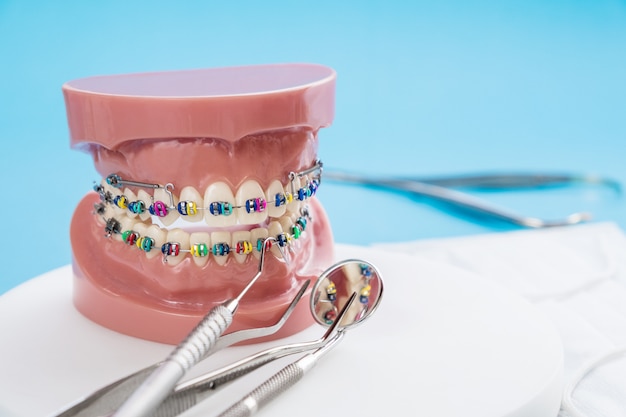 Dentist tools and orthodontic model on blue background.