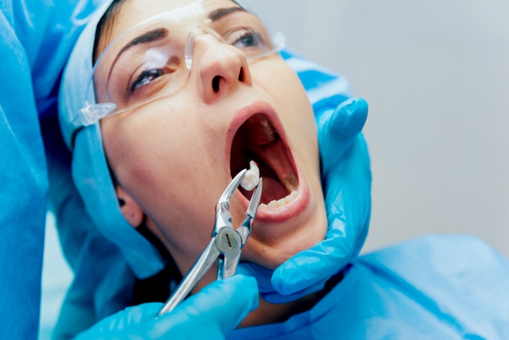 Photo dentist using surgical pliers to remove a decaying tooth. modern dental clinic
